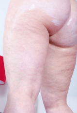 Hot mature with curly hair applies body cream