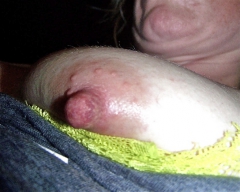 Nips - N