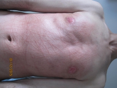 My tits in pain (nipples removed) - N