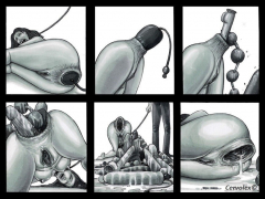 anal hole - N
