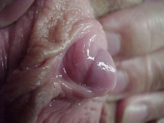 Clit Panorama - N