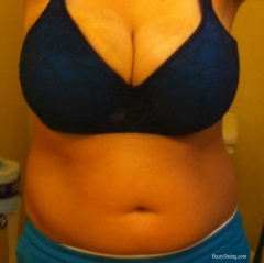 Busty Breast Reductions - Set 17 - N